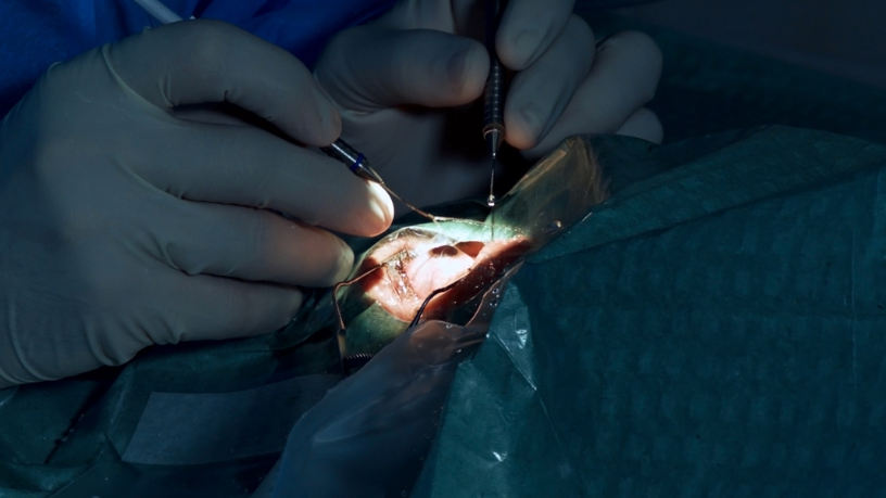 Precisão em microcirurgia garante vascularização e resultados funcionais superiores, observa Dr. Milton Seigi Hayashi.